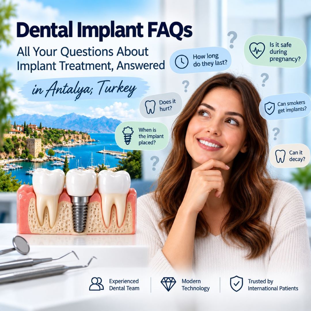 Dental implant treatment FAQs in Antalya, Turkey