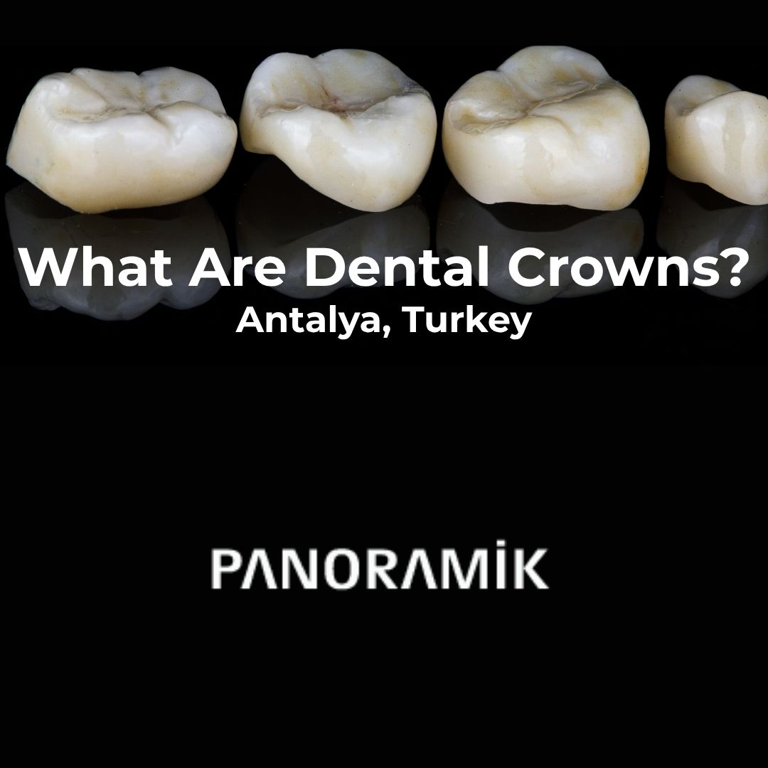 Dental crowns in Antalya Turkey